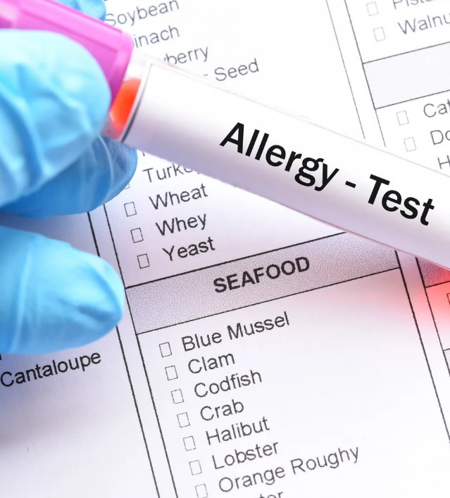 test alergiczny